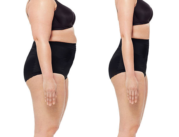 Weight Management